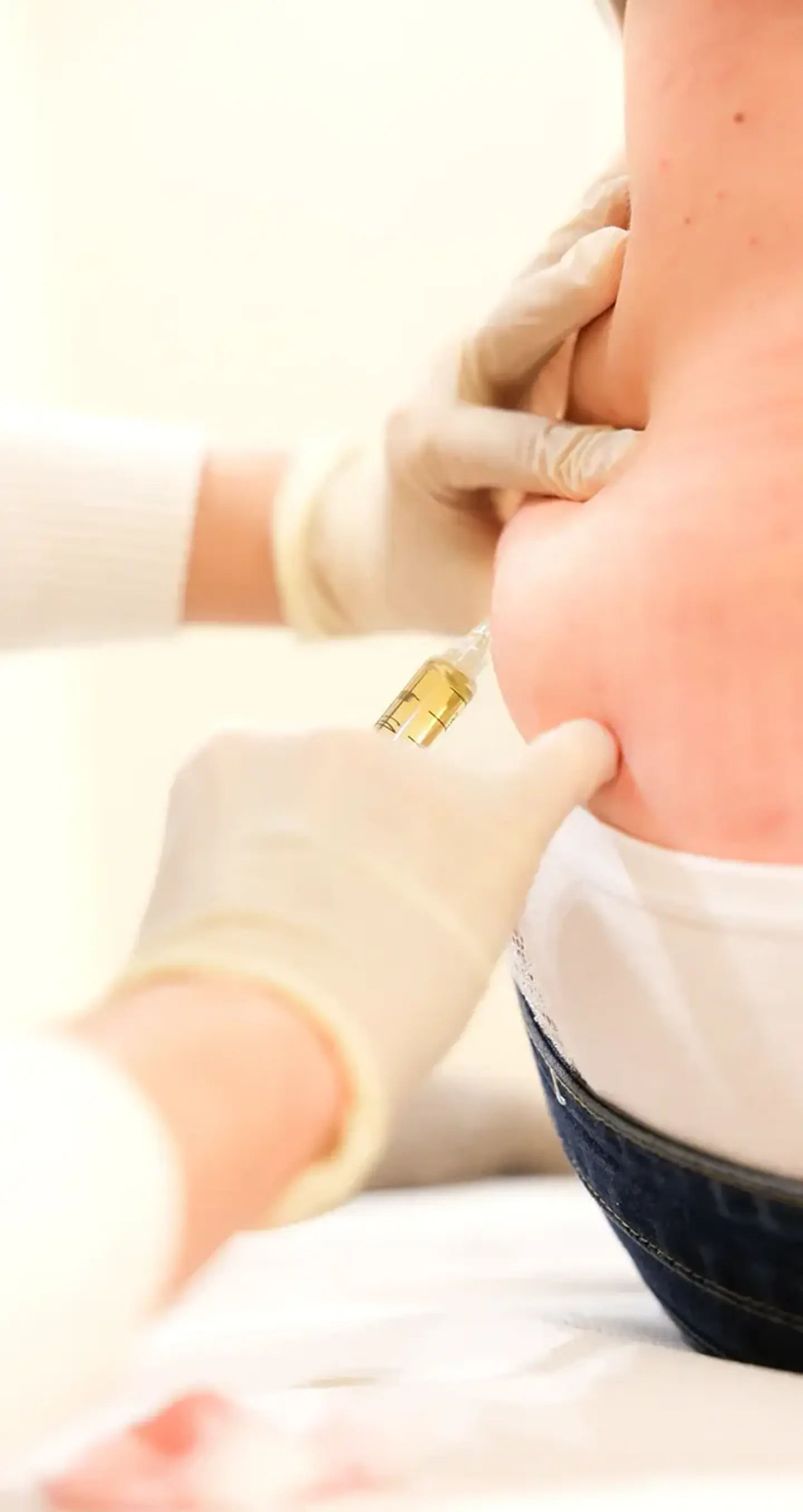 Mesoterapia