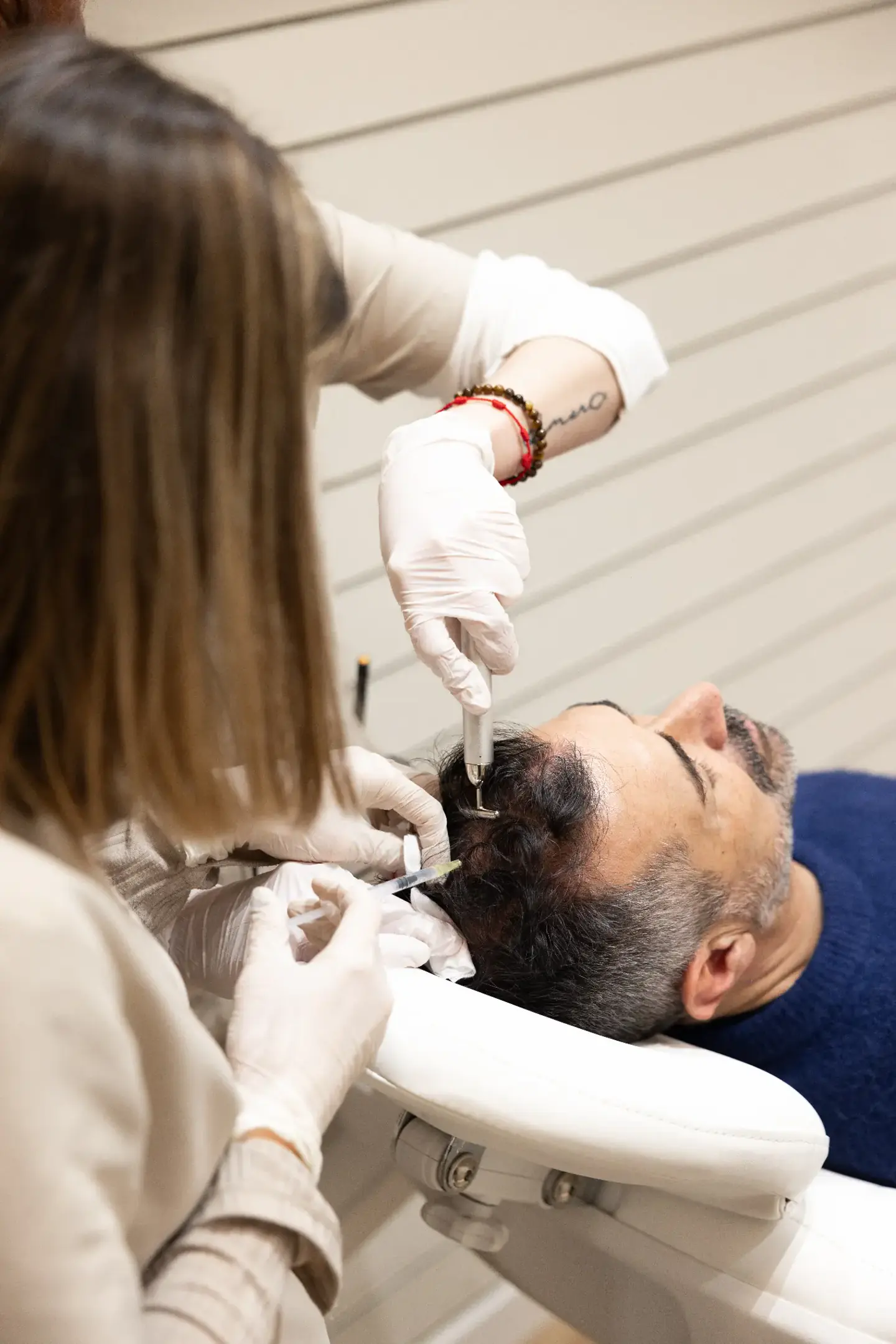 Mesoterapia Capilar